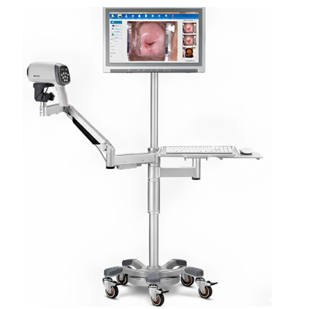 Edan HD Digital Video Colposcope - Image 11