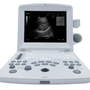 EDAN DUS60 Ultrasound Black & White Ultrasonic Imaging With Two Probes Linear And Convex