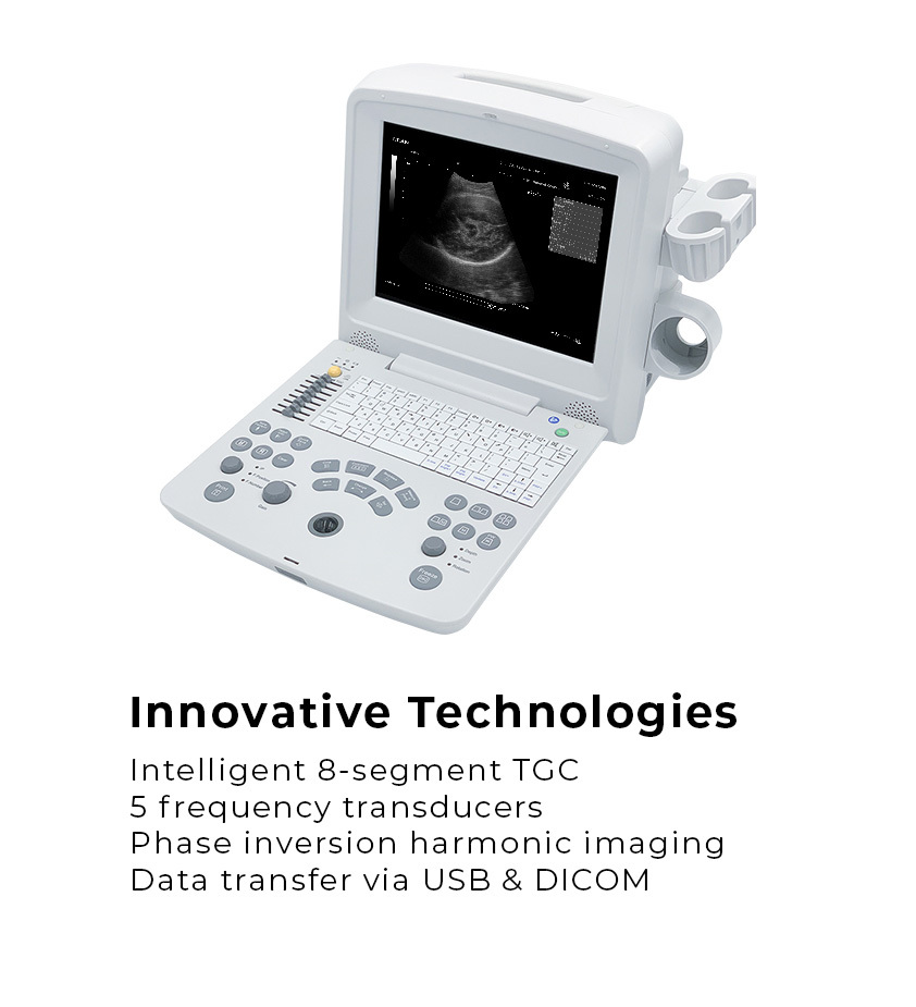 EDAN DUS60 Ultrasound Black & White Ultrasonic Imaging With Two Probes Linear And Convex - Image 3