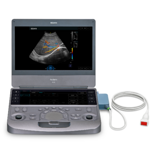 EDAN Acclarix AX8 Compact Ultrasound System